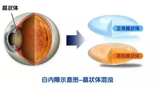 白蛋白_玉兰油蛋白乳液白滑面膜_牛奶蛋白过敏能吃蛋白吗