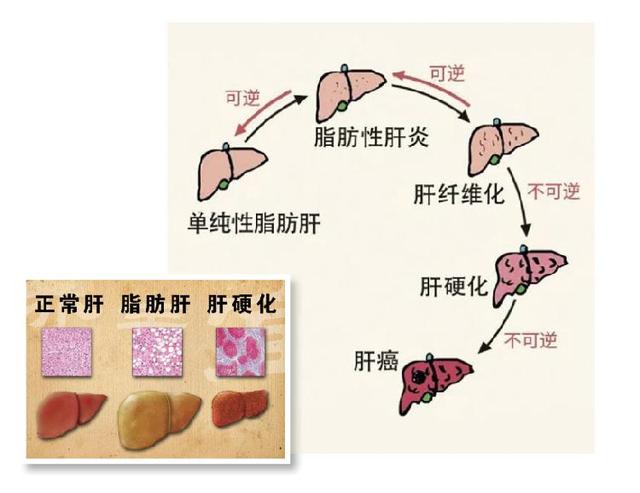 牛磺酸的功效与作用_牛黄的功效与作用及禁忌_牛髓的功效与作用