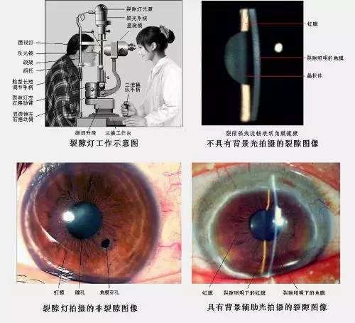 裂隙灯显微镜_灯显微镜裂隙怎么办_灯显微镜裂隙怎么处理